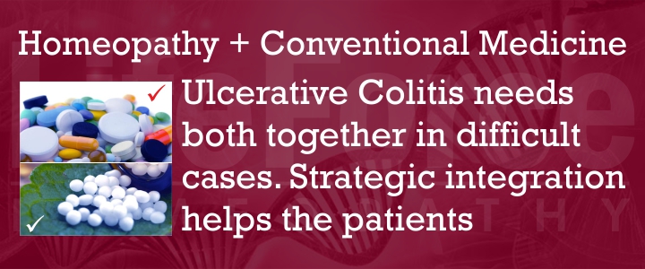Conventional treatment for Ulcerative Colitis
